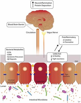 The Gut-Brain Axis in Neurodegenerative Diseases and Relevance of the Canine Model: A Review